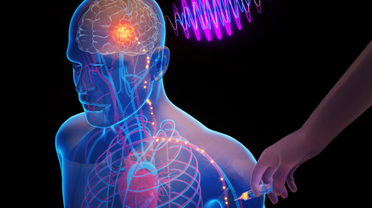 diagram of head and shoulders with an electrical implant